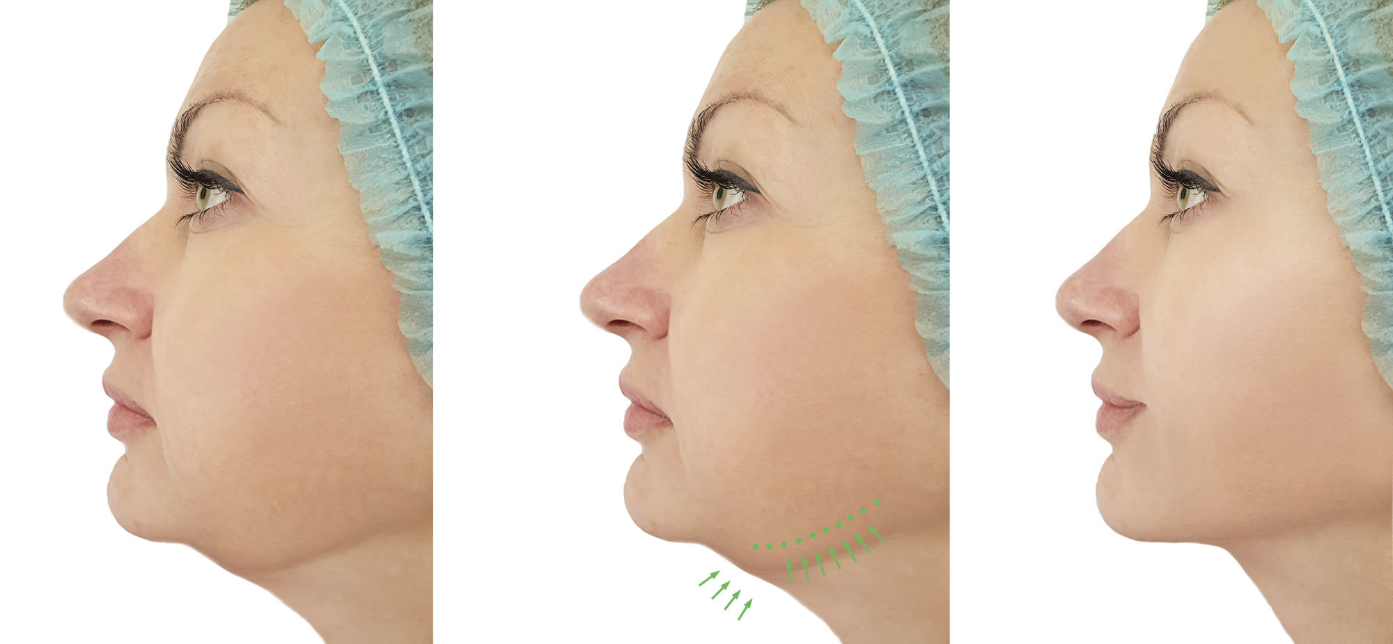 Digital marketing for plastic surgeons